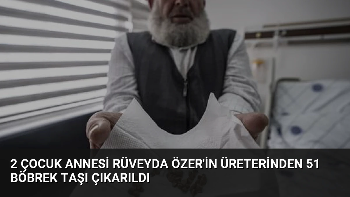 2 çocuk annesi Rüveyda Özer’in üreterinden 51 böbrek taşı çıkarıldı