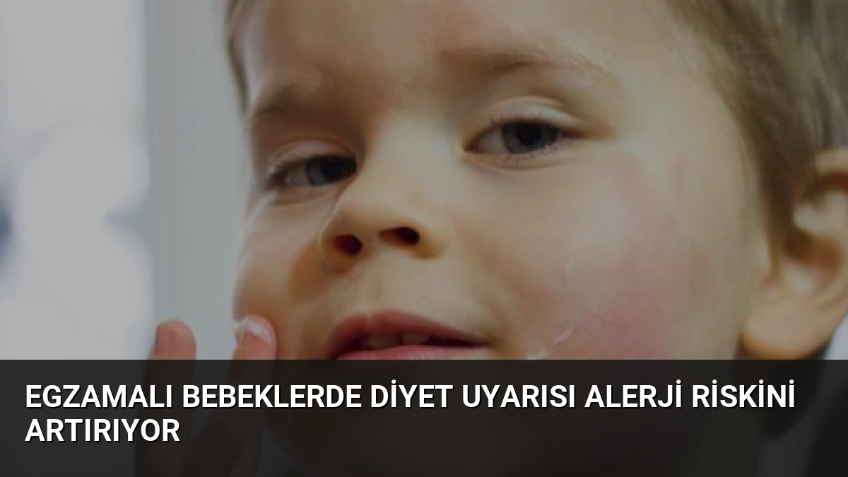 Egzamalı Bebeklerde Diyet Uyarısı Alerji Riskini Artırıyor