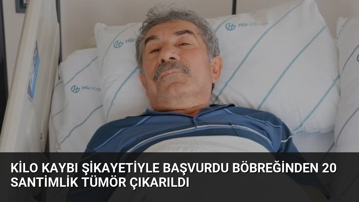Kilo Kaybı Şikayetiyle Başvurdu Böbreğinden 20 Santimlik Tümör Çıkarıldı
