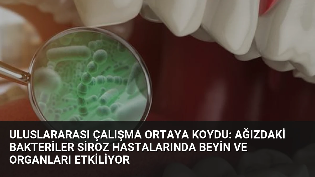 Uluslararası Çalışma Ortaya Koydu: Ağızdaki Bakteriler Siroz Hastalarında Beyin ve Organları Etkiliyor