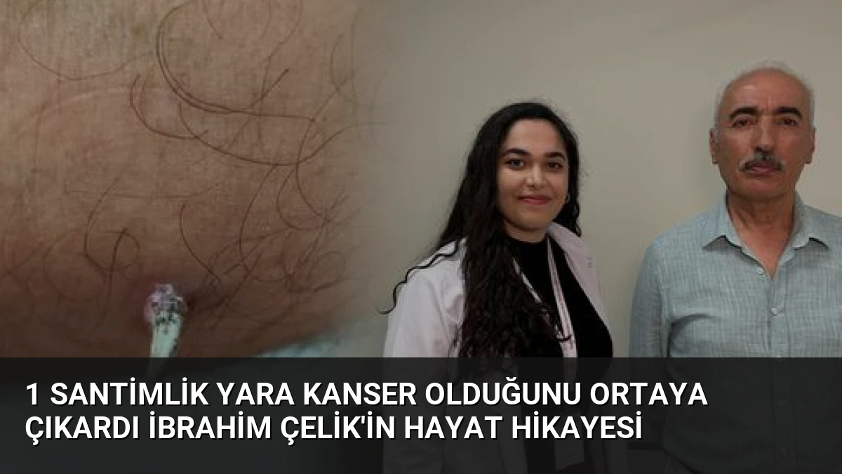 1 Santimlik Yara Kanser Olduğunu Ortaya Çıkardı İbrahim Çelik’in Hayat Hikayesi