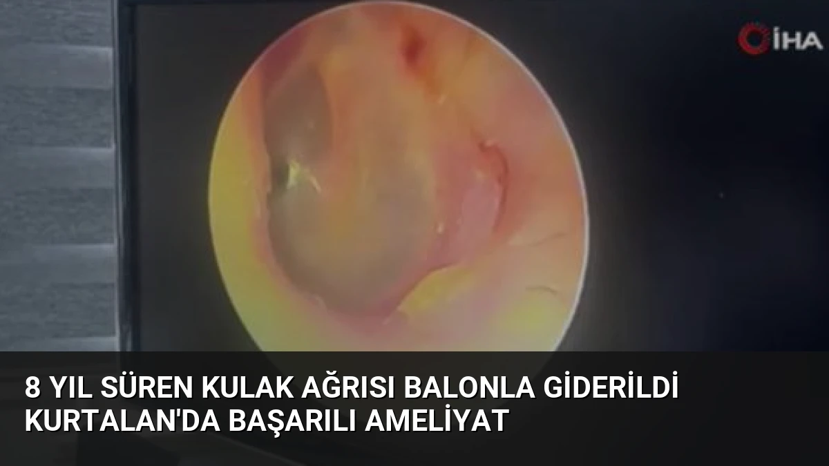 8 Yıl Süren Kulak Ağrısı Balonla Giderildi Kurtalan’da Başarılı Ameliyat