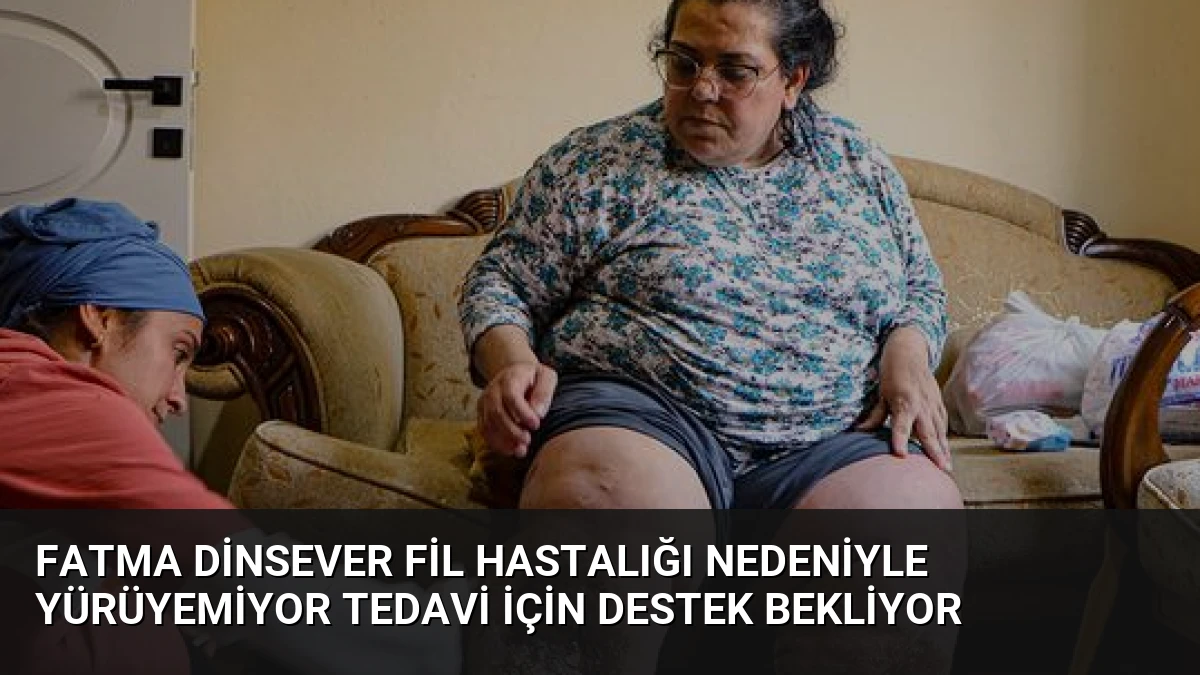 Fatma Dinsever Fil Hastalığı Nedeniyle Yürüyemiyor Tedavi İçin Destek Bekliyor